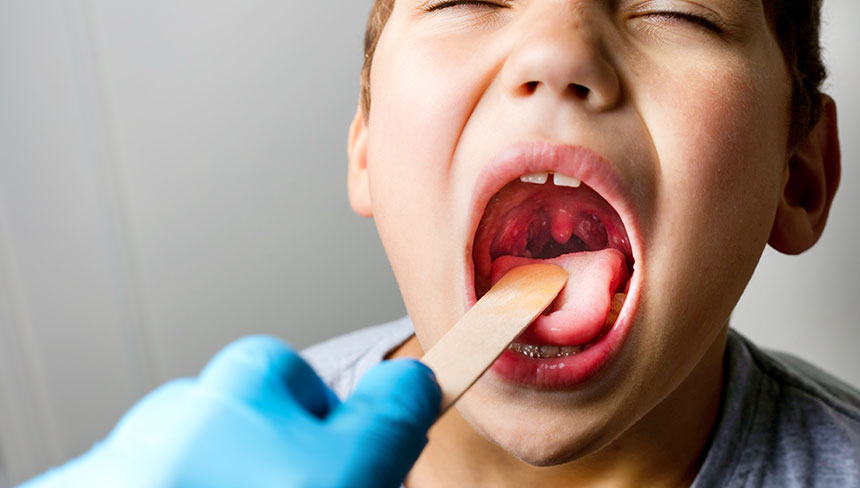 patient needing tonsillitis treatment in Monterey Park